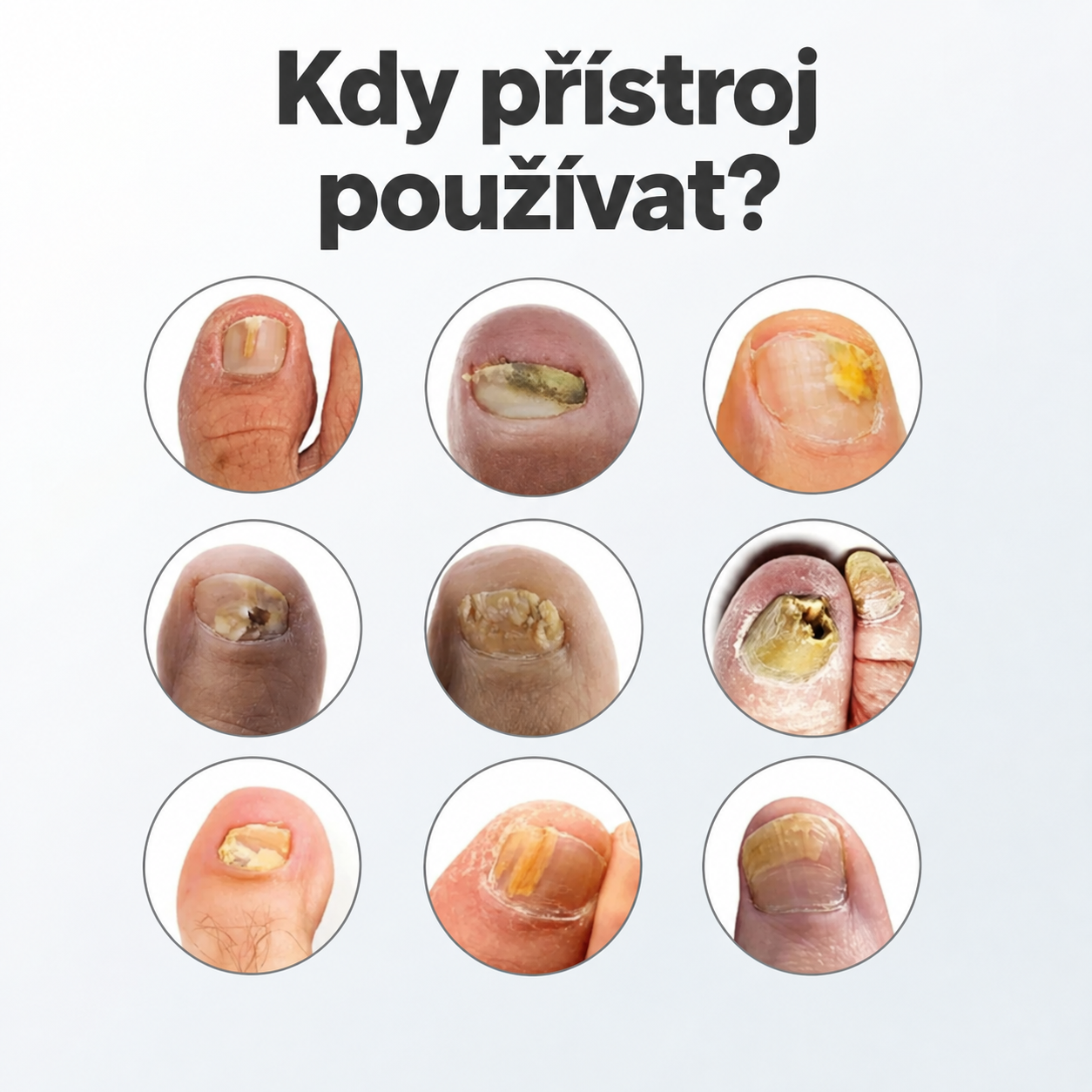 NuvoCare™